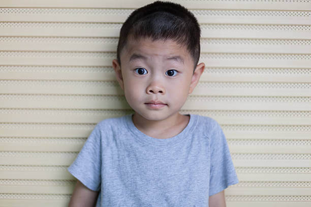 mắt cận lệch