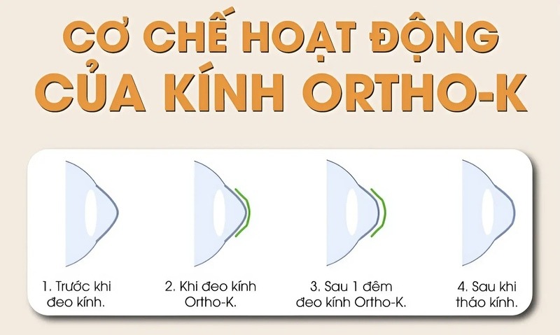 Cách hoạt động của kính Ortho-K