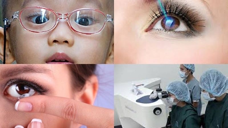Các phương pháp điều chỉnh hiện đại có thể giúp cải thiện tình trạng loạn thị