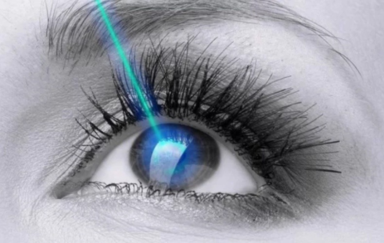 Mổ mắt Epi-LASIK có an toàn không?
