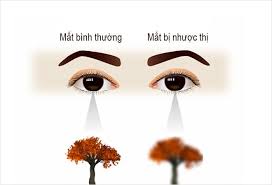 nhuoc-thi