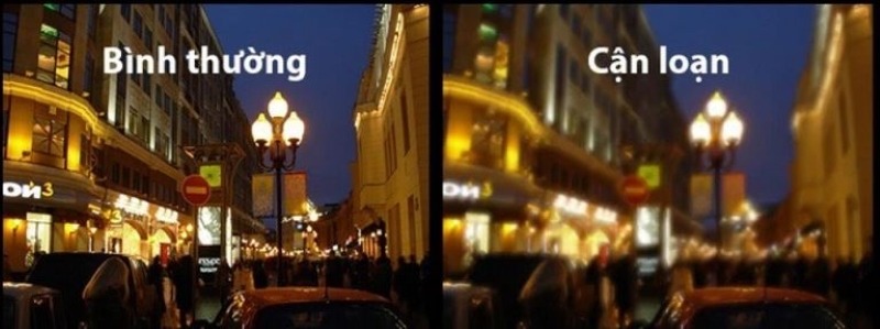 Thế nào là mắt cận loạn?